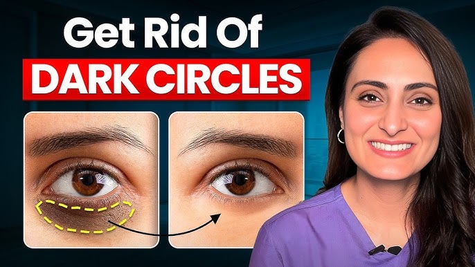 Under‑eye dark circles showing reasons and real skincare solutions using gentle eye care by YUSMA