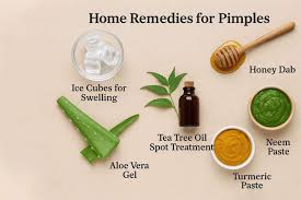 Home remedies for pimples including aloe vera gel and tea tree oil spray from Iris Osbey Herbal Skin Care