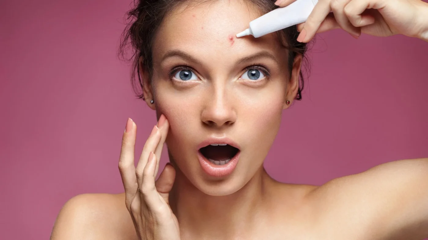 Azelaic acid tube and bottle with ingredients like rosacea redness, acne bumps, and hyperpigmentation spots illustrated around it